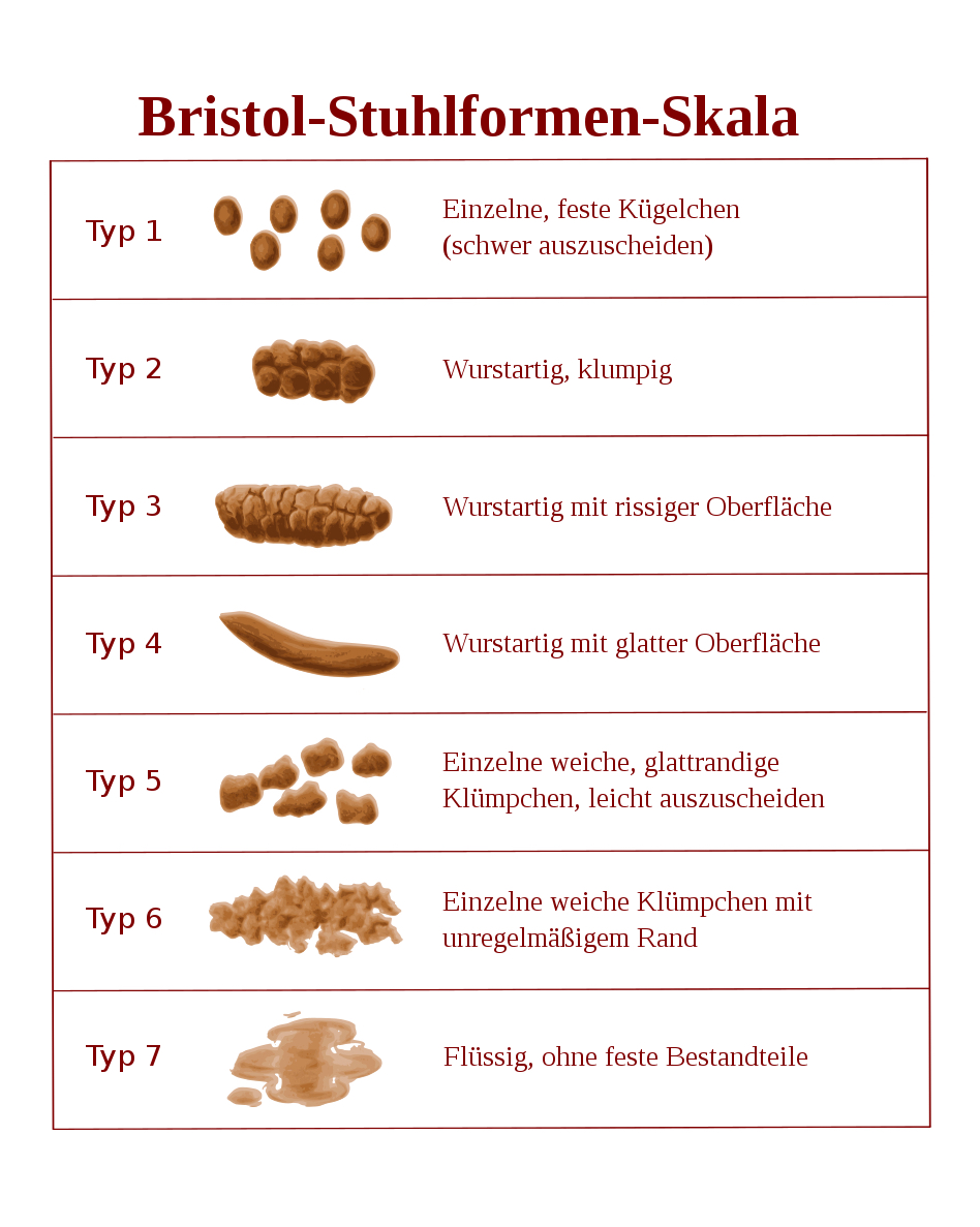Bristol-Stuhlformen-Skala